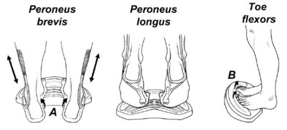 BIHC - Belleville Integrative Health Centre - 🦶🏼Plantar Fasciitis🦶🏼 .  You may have PF if you have: 💢Heel/bottom of your foot pain 💢Worst first  thing in the morning or after sitting for