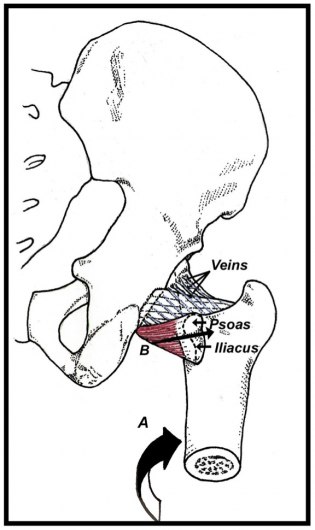 Tight hip flexors are a real pain - Bone & Joint